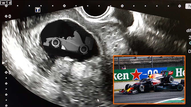 Auto's Verstappen en Hamilton verwachten een kleintje