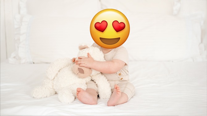 Kinderartsen slaan alarm over ernstige gezichtsafwijking bij baby's