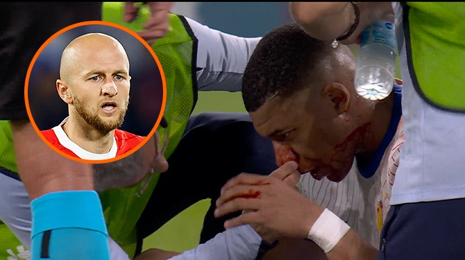 Trauner leent pleister uit aan Mbappé