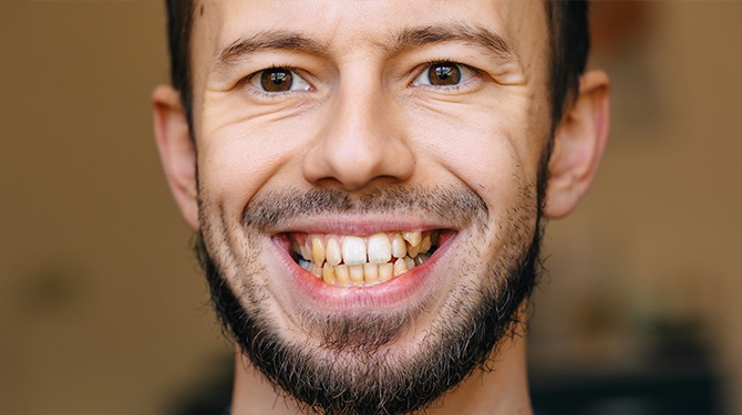 Joey voelt zich beter dan ooit met voedingssupplementen ondanks spierverzwakking, buikkrampen, diarree, wazig zicht en verlammingsverschijnselen