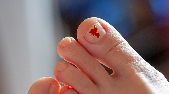 Restje nagellak op teen bewijs dat zomer ooit bestond